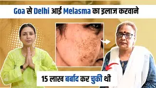 How to remove Pigmentation Naturally | Hyperpigmentation Patient *Review* | Dr. Upasana Vohra