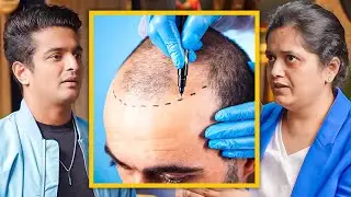 Hair Transplant EASY Explanation By Celebrity Hair Doc (HINDI EXPLANATION)
