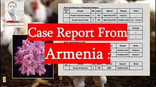 Case Report Multi Viral Infection Complex
