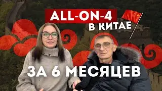 ПОЛНОЕ ПРОТЕЗИРОВАНИЕ НА ОБЕ ЧЕЛЮСТИ ИЛИ ALL-ON-FOUR за 6 месяцев 