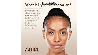 Обзор крема Ambi Even & Clear Fade: действительно ли он осветляет темные пятна за 4 недели?