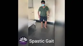 SPASTIC GAIT