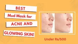 Mud Mask For Face | Get Glowing Skin & Acne Control Under Rs/500 | 🇵🇰 Summer Skincare Routine
