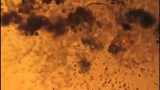 Rotifer feeding (Rotaria rotatoria)