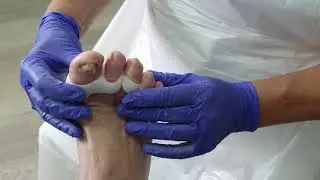 Pedisil Soft Gel Teenspreider T1 t/m T5 en Bunion Beschermer (RPSIL0 0070)