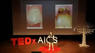 The Power of Preventative Care | Palmis Yahoo | TEDxYouth@AICS