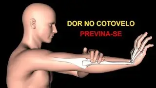 EPICONDILITE - Exercícios que ajudam a prevenir e aliviar a dor no cotovelo