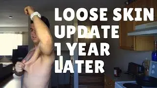 My Loose Skin Update | Tips on Preventing It & Making it Better | FAQ Fridays