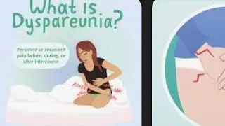 What is dyspareunia its symptoms ,causes & treatment #women