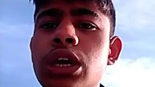 ratondhi rog