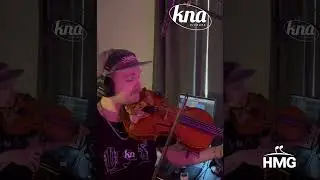 KNA VV-3V vs Micr&oacute;fono de Ambiente | Sonido limpio y natural en guitarra