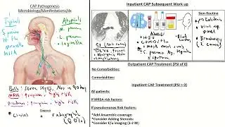 Quick Hits: Approach to CAP (Community Acquired pneumonia)