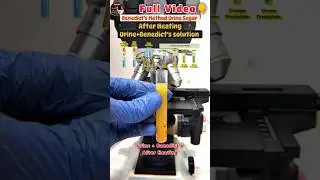 Benedict's Method Urine Sugar 😱#urine #medical  #shortsvideo #shorts