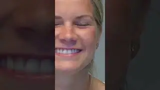 How it started 🆚 how it&rsquo;s going 🥰|Ada Hegerberg (Norwegian footballer) #shorts #football