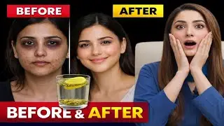 Stop Using Expensive Creams! The Real Face Glow Comes From Inside | Dr Sadia khan.
