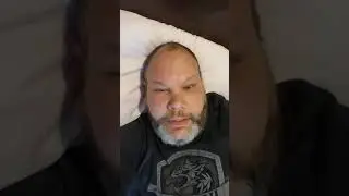 Peroneal Tendon Surgery Recovery day5