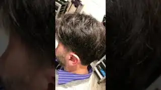Patch Capillare Uomo  Riavere i capelli in 60 minuti    www.augustomirkodilascio.com