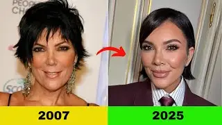 Everything About Kris Jenner's Plastic Surgery History