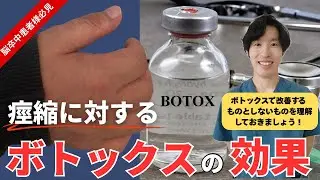 【脳卒中当事者の皆さん必見】ボトックスの効果と落とし穴を徹底解説