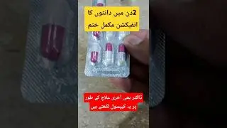 &ldquo;Danton Ke Infection Ka Tez Ilaaj | Ye Capsule 2 Din Mein Asar Karega&rdquo;