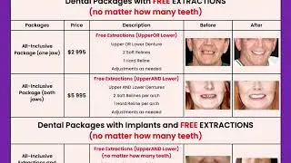 Denture Packages and Specials in Sun City West