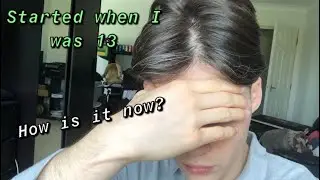 GREYING HAIR AGE 13  - my experience