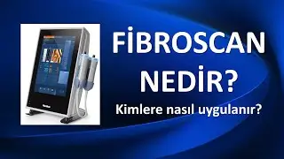 FibroScan Nedir? Kimlere, Nasıl Uygulanır?