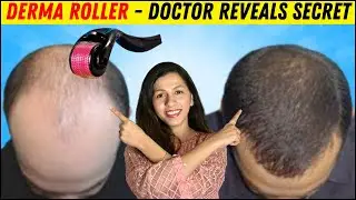 Derma Roller for Hair Growth EXPOSED &ndash; Doctor Breaks the Silence | Dr Madiha Bhayani | Microneedling