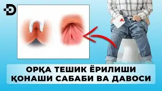 ОРҚА ТЕШИК ЁРИЛИШИ, ҚОНАШИ САБАБИ ВА УЙ ШАРОИТИДА ДАВОЛАШ ЧОРАСИ