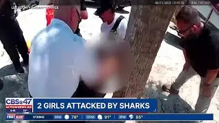 Shark Attacks: Florida girl almost loses hand, S.C. girl bitten in leg