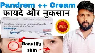 Pandrem ++| Panderm plus cream को केसे   लगाए | how to use panderm plus cream #pandrempluscream