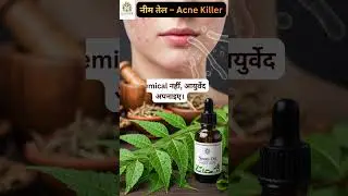Neem Oil for Acne | Eliminates Acne from the Root | Ayurveda Skin Care