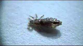 Die Laus The louse