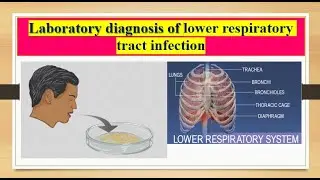 Laboratory diagnosis of lower respiratory tract infections: sputum culture