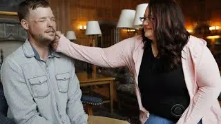 Emotional meeting for face transplant recipient