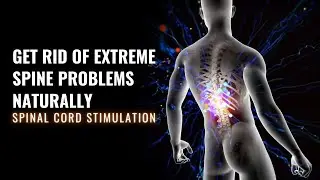 Spinal Cord Stimulation- Get Rid of Extreme Spine Problems Naturally-Cure for Spinal Cord Pain-528hz