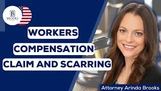 Brooks Law Firm - Workers Compensation Claim and Scarring