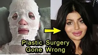 8 Bollywood Actress Plastic Surgery Gone Wrong | Then and Now