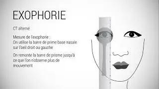 HETEROPHORIES
