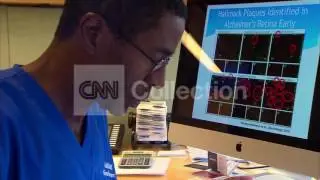 RETINAL IMAGING TO DETECT ALZHEIMER'S