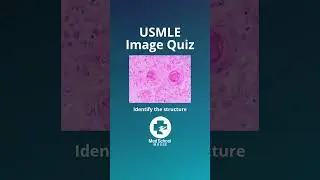 ⬆️More high yield USMLE here | 📌Answer in comments #usmle #usmlestep1 #medstudent #medschool #shorts