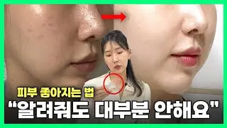 알려주기 아까운 피부관리법ㅣ모두가 알면 피부과,피부샵 다 망해요..