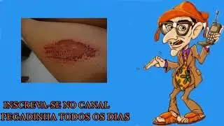 Pegadinha do Mução - Casca de Ferida 1 e 2 (SEM CORTES) (COMPLETAS)