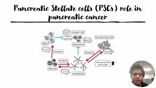 Pancreatic Stellate Cells (PSCs) multifaceted role in pancreatic cancer development #Code: 1032