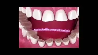 Do yu grind your teeth at night?