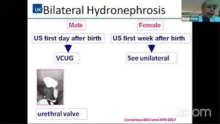 paediatric case based discussion - Moderated Dr Anil Takvani