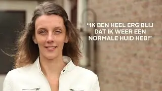 Succesvolle eczeem behandeling : Medisch Centrum MeCeBi