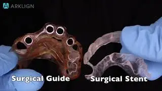 Surgical guide and surgical stent for dental implants.
