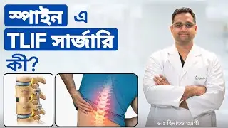 স্পাইন এ TLIF সার্জারি কী? | What is TLIF surgery in spine ? in Bengali