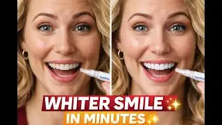 PearliPen Teeth Whitening Review | My Real Experience After 7 Days (Does It Work?) #teethwhitening